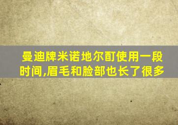 曼迪牌米诺地尔酊使用一段时间,眉毛和脸部也长了很多